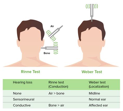 weber test with cerumen impaction|weber test for auditory loss.